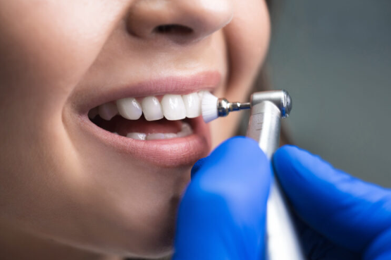Bodrum’da diş tedavisi ve dental turizm rehberi. Bodrum’daki modern diş klinikleri, implant tedavisi, zirkonyum kaplama, E-Max veneer, gülüş tasarımı, diş beyazlatma ve tatil ile birleşen kaliteli dental sağlık hizmetleri hakkında bilgiler.