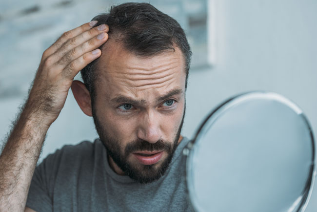 Hair Transplant in Izmir