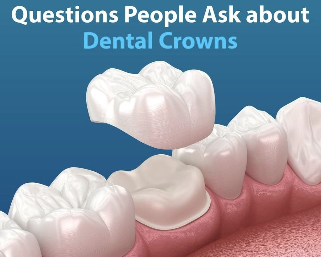 Dental Crowns in Bodrum
