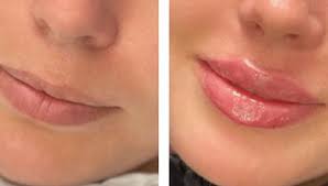 Russian Lips Bodrum