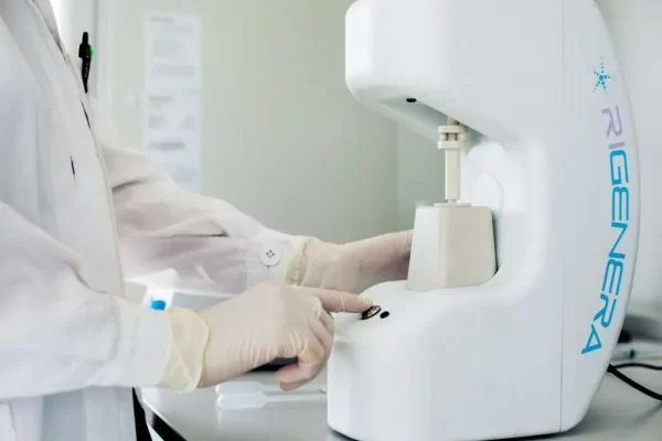 Regenera Activa Hair Transplant in İstanbul and Antalya