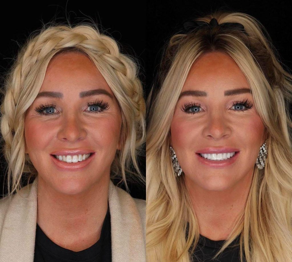 Dentist in Rhodes & Marmaris