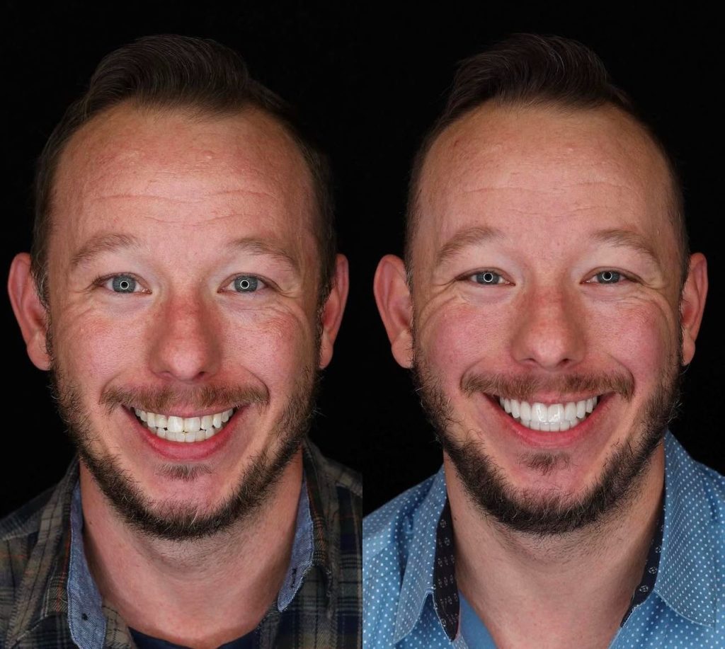 Dentist in Rhodes & Marmaris