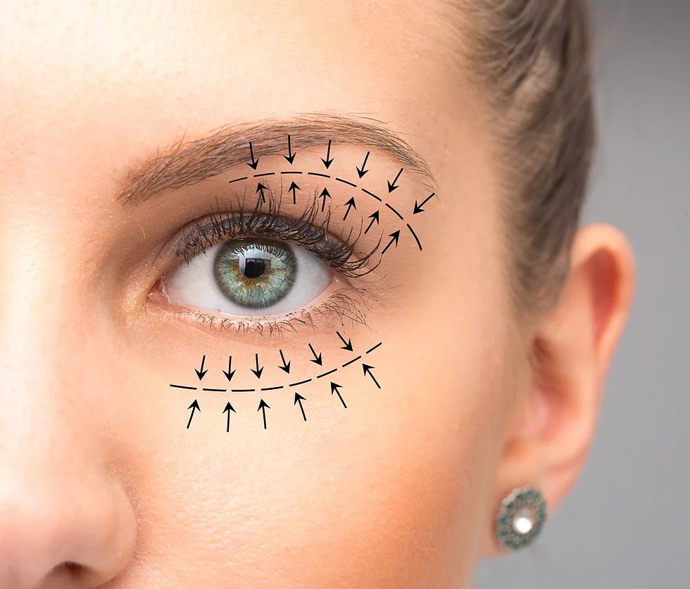 How Much Does Eyelid Surgery Cost in Turkey?