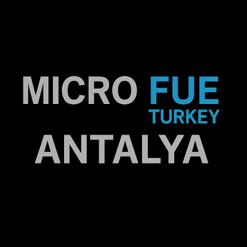 Planning a Hair Transplant in Antalya