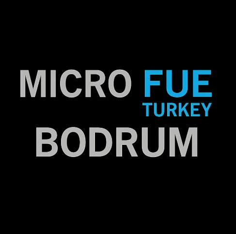 Hair Transplant Bodrum