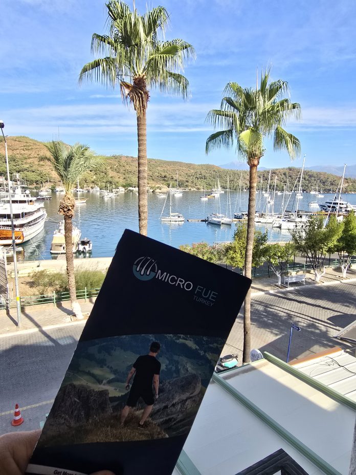 Hair Transplant in Fethiye