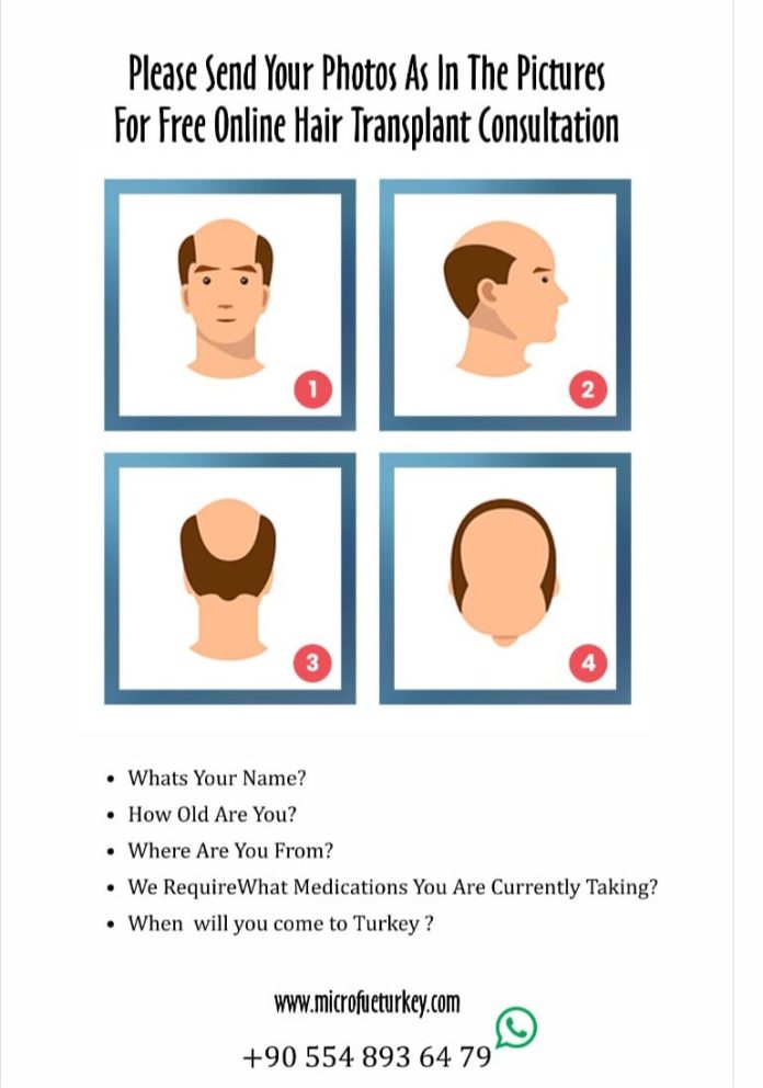 Hair Transplant Consultation