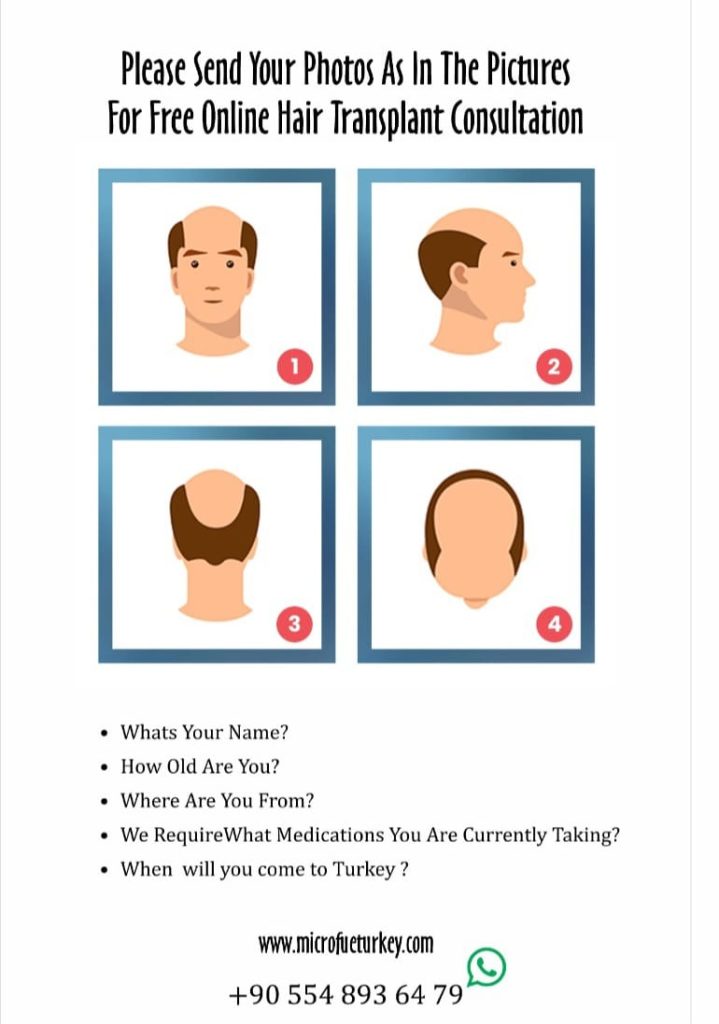 Hair Transplant Consultation