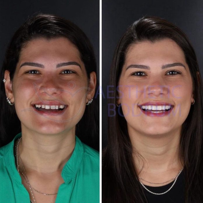 Bodrum Dental Tourism