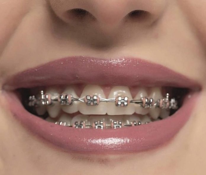 Comparing Winter and Summer Dental Implant Travel in Bodrum