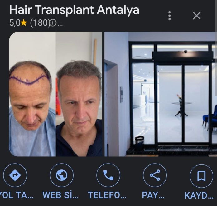 How Affordable is Hair Transplant in Antalya?
