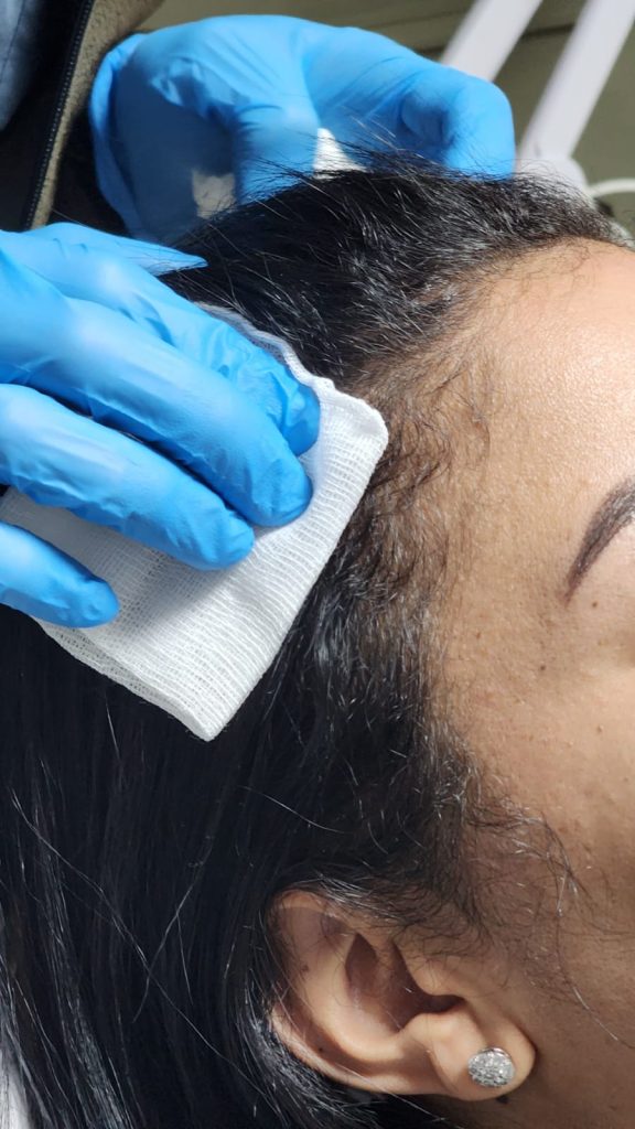 Exosome Treatment in Antalya