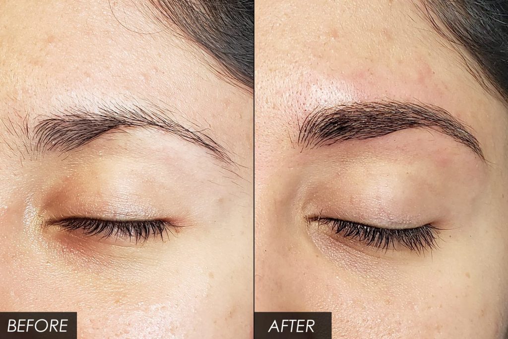 Eyebrow and Hair Microblading in Bodrum, Marmaris, and Fethiye
